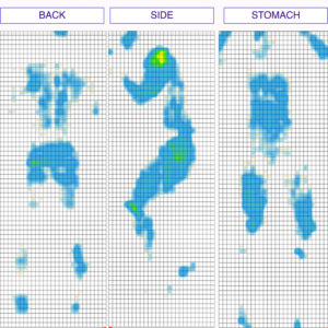 Emma Pressure Map